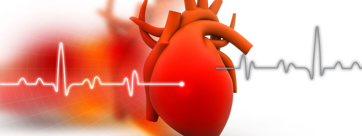 Entienda su riesgo para prevenir un ataque al corazón
