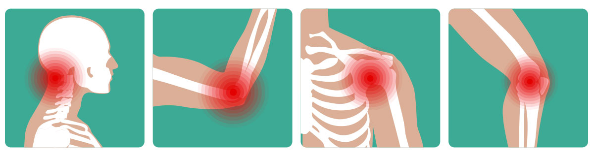 Consejos para la salud de las articulaciones: Alivia el dolor de la artritis